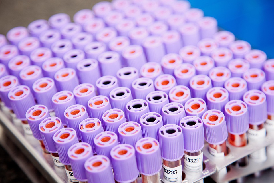How to Craft an Impressive Cover Letter for a Laboratory Analyst Position: Tips and Examples