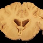 Crafting an Impressive Veterinary Surgeon Cover Letter: Tips and Examples for Success